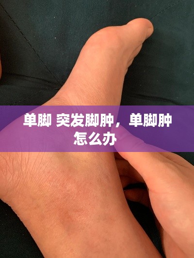 单脚 突发脚肿，单脚肿怎么办 